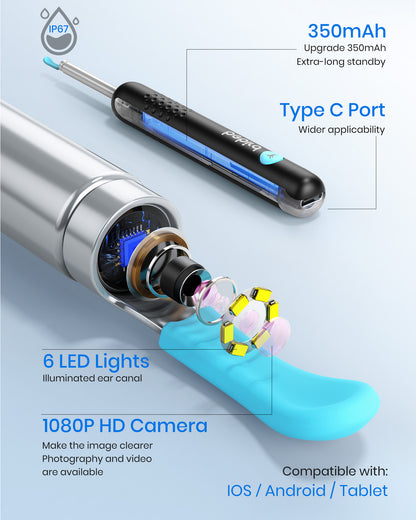 Otivue WiFi HD Camera Earwax Removal Tool