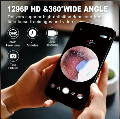 Otivue WiFi HD Camera Earwax Removal Tool