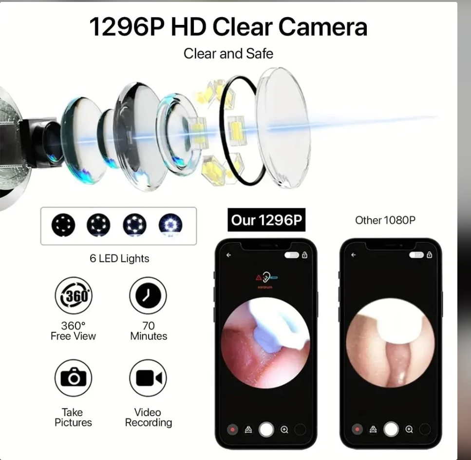 Otivue WiFi HD Camera Earwax Removal Tool