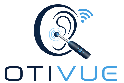 Otive Camera Earwax Removal Device