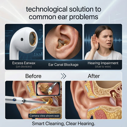 Earwax Removal Tool with HD Camera